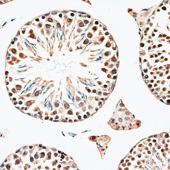 Immunohistochemistry of paraffin-embedded Mouse testis using CBX6 Polyclonal Antibody at dilution of  1:100 (40x lens).