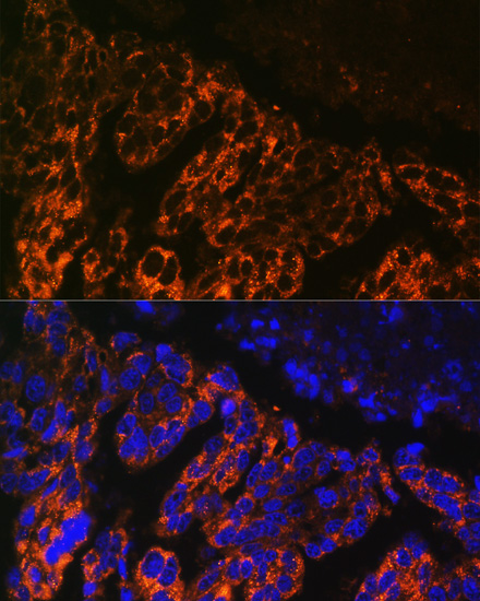 Immunofluorescence analysis of Human lung cancer cells using SCNN1A Polyclonal Antibody at dilution of  1:100. Blue: DAPI for nuclear staining.