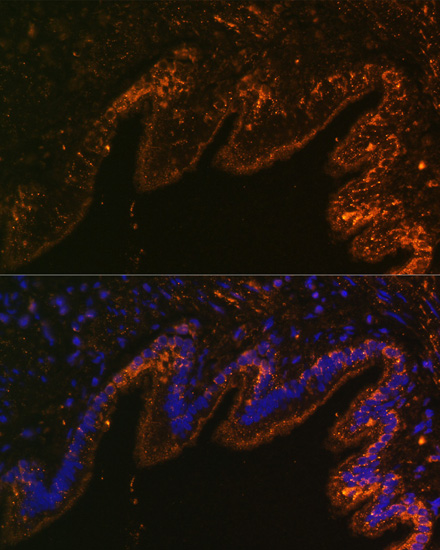 Immunofluorescence analysis of Rat lung cells using SCNN1A Polyclonal Antibody at dilution of  1:100. Blue: DAPI for nuclear staining.