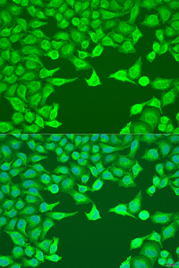 Immunofluorescence analysis of U2OS cells using ATG9A Polyclonal Antibody at dilution of  1:100. Blue: DAPI for nuclear staining.