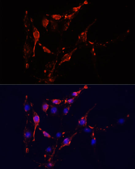 Immunofluorescence analysis of PC12 cells using ICAM1 Polyclonal Antibody at dilution of  1:100. Blue: DAPI for nuclear staining.