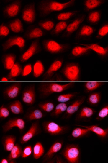 Immunofluorescence analysis of U2OS cells using ZEB1 Polyclonal Antibody