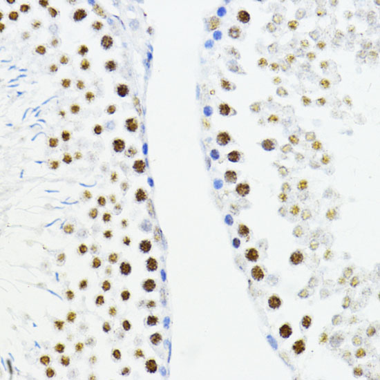 Immunohistochemistry of paraffin-embedded Rat testis using ZEB1 Polyclonal Antibody at dilution of  1:200 (40x lens).