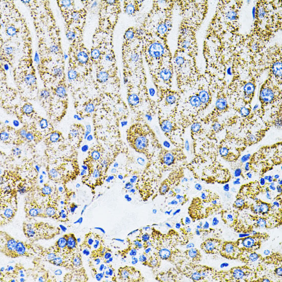 Immunohistochemistry of paraffin-embedded Human liver damage using EPO Polyclonal Antibody