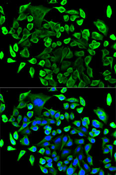 Immunofluorescence analysis of U2OS cells using TAB1 Polyclonal Antibody