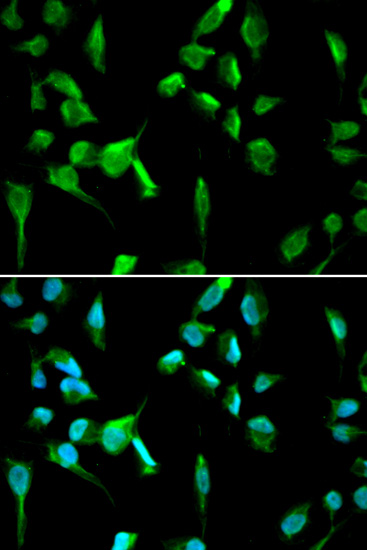 Immunofluorescence analysis of A549 cells using TOPBP1 Polyclonal Antibody
