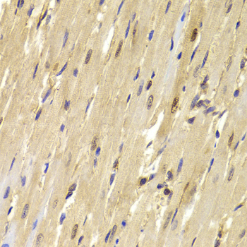 Immunohistochemistry of paraffin-embedded Mouse heart using TOPBP1 Polyclonal Antibody at dilution of  1:100 (40x lens).