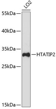 Western blot analysis of extracts of LO2 cells using HTATIP2 Polyclonal Antibody at dilution of 1:3000.