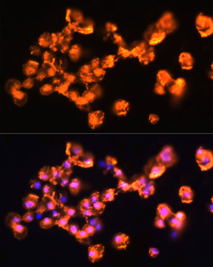 Immunofluorescence analysis of A431 cells using PRKCB Polyclonal Antibody at dilution of  1:100. Blue: DAPI for nuclear staining.