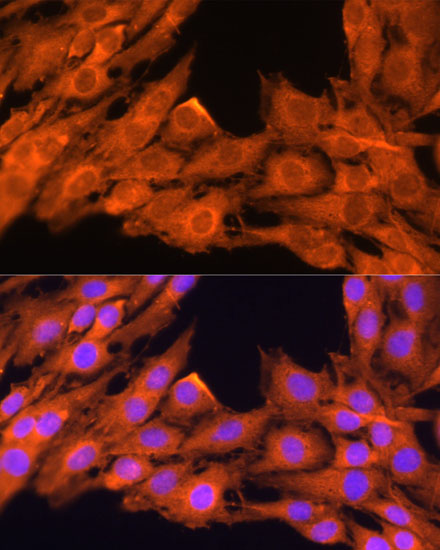 Immunofluorescence analysis of C6 cells using PRKCB Polyclonal Antibody at dilution of  1:100. Blue: DAPI for nuclear staining.