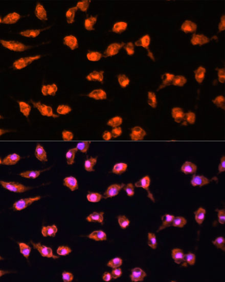 Immunofluorescence analysis of L929 cells using PRKCB Polyclonal Antibody at dilution of  1:100. Blue: DAPI for nuclear staining.