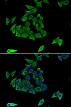 Immunofluorescence analysis of U2OS cells using TGM3 Polyclonal Antibody