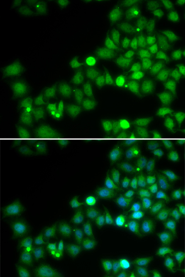 Immunofluorescence analysis of U2OS cells using POLK Polyclonal Antibody