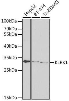 Western blot analysis of extracts of various cell lines using KLRK1 Polyclonal Antibody at dilution of 1:1000.