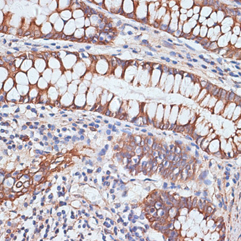 Immunohistochemistry of paraffin-embedded Human colon using PIGR Polyclonal Antibody at dilution of  1:100 (40x lens).