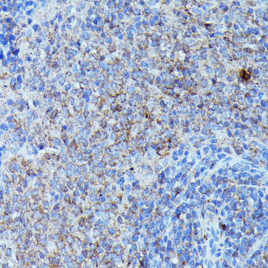 Immunohistochemistry of paraffin-embedded Rat spleen using CSF3 Polyclonal Antibody at dilution of  1:100 (40x lens).
