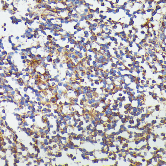 Immunohistochemistry of paraffin-embedded Human colon using CSF3 Polyclonal Antibody at dilution of  1:100 (40x lens).