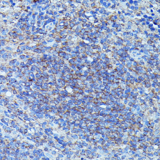 Immunohistochemistry of paraffin-embedded Mouse spleen using CSF3 Polyclonal Antibody at dilution of  1:100 (40x lens).