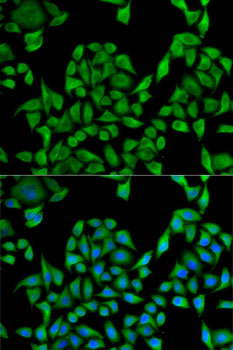 Immunofluorescence analysis of U2OS cells using UGT1A1 Polyclonal Antibody