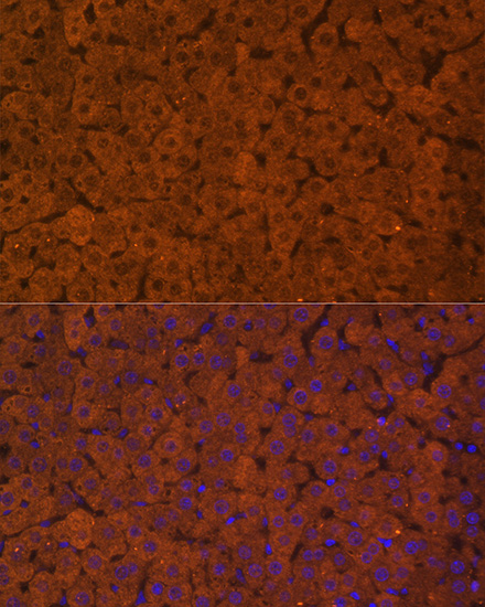 Immunofluorescence analysis of Rat liver using UGT1A1 Polyclonal Antibody at dilution of  1:100. Blue: DAPI for nuclear staining.