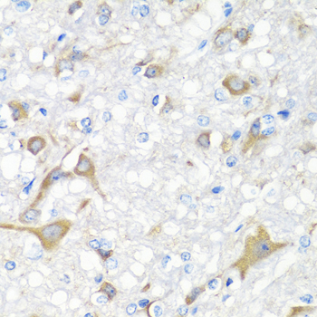 Immunohistochemistry of paraffin-embedded Rat brain using IL22 Polyclonal Antibody at dilution of  1:100 (40x lens).