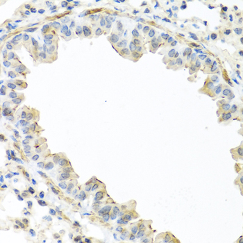 Immunohistochemistry of paraffin-embedded Mouse lung using IL22 Polyclonal Antibody at dilution of  1:100 (40x lens).