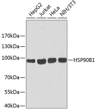 Western blot analysis of extracts of various cell lines using HSP90B1 Polyclonal Antibody.