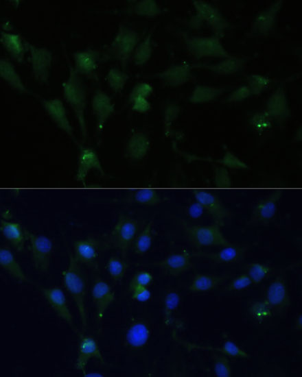 Immunofluorescence analysis of C6 cells using ZWINT Polyclonal Antibody at dilution of  1:100 (40x lens). Blue: DAPI for nuclear staining.