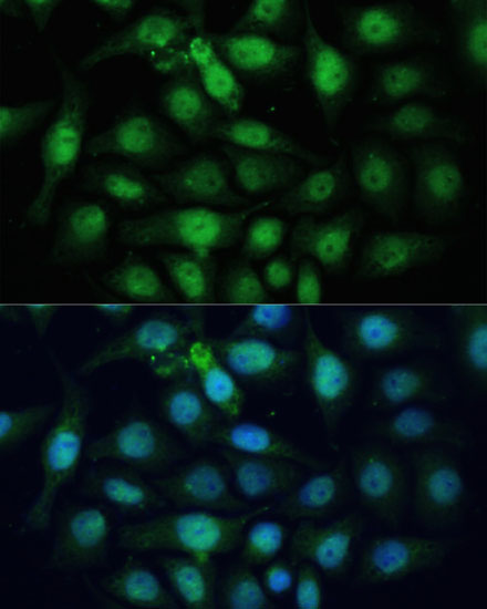 Immunofluorescence analysis of HeLa cells using ZWINT Polyclonal Antibody at dilution of  1:100 (40x lens). Blue: DAPI for nuclear staining.