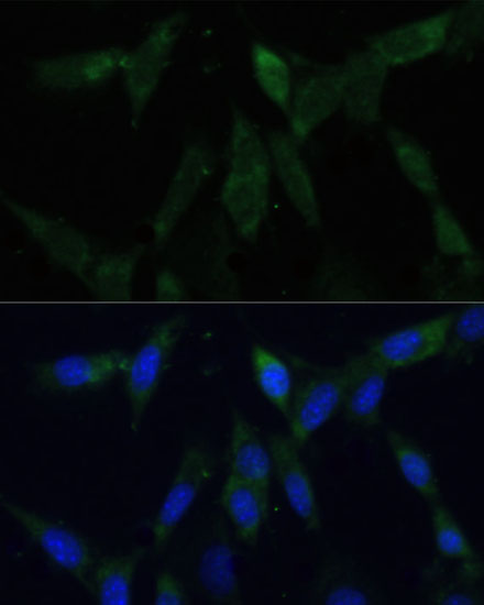 Immunofluorescence analysis of NIH-3T3 cells using ZWINT Polyclonal Antibody at dilution of  1:100 (40x lens). Blue: DAPI for nuclear staining.