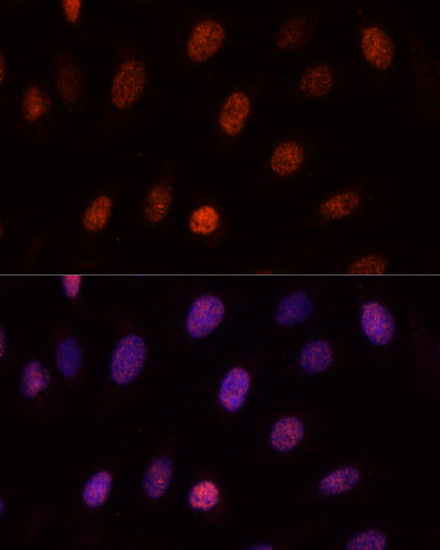 Immunofluorescence analysis of U-2OS cells using PCGF1 Polyclonal Antibody at dilution of  1:100. Blue: DAPI for nuclear staining.