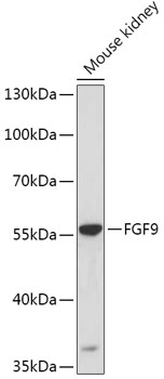 Western blot analysis of extracts of Mouse kidney using FGF9 Polyclonal Antibody at dilution of 1:1000.