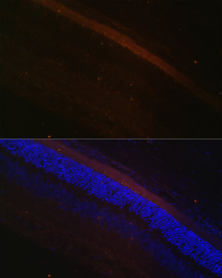 Immunofluorescence analysis of Rat retina using GRK1 Polyclonal Antibody at dilution of  1:100 (40x lens). Blue: DAPI for nuclear staining.