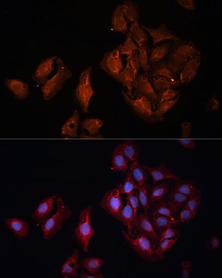 Immunofluorescence analysis of U-2 OS cells using BAP1 Polyclonal Antibody at dilution of  1:100 (40x lens). Blue: DAPI for nuclear staining.