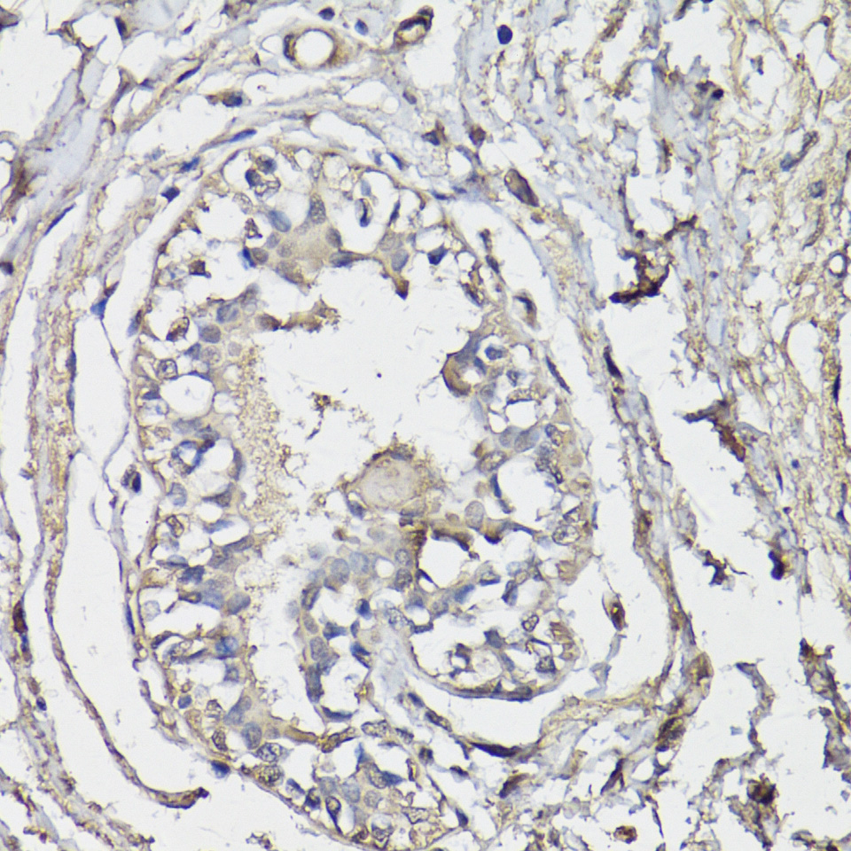 Immunohistochemistry of paraffin-embedded Human breast using BAP1 Polyclonal Antibody at dilution of  1:150 (40x lens).