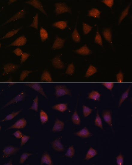 Immunofluorescence analysis of L929 cells using TREX1 Polyclonal Antibody at dilution of  1:100. Blue: DAPI for nuclear staining.