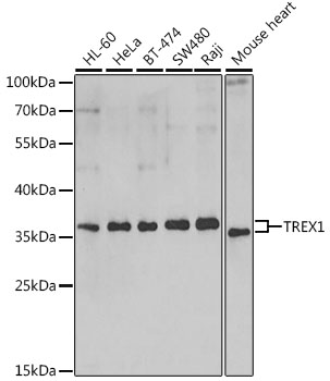 Western blot analysis of extracts of various cell lines using TREX1 Polyclonal Antibody at dilution of 1:1000.