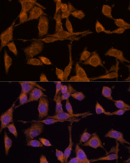 Immunofluorescence analysis of HeLa cells using USP15 Polyclonal Antibody at dilution of  1:100 (40x lens). Blue: DAPI for nuclear staining.