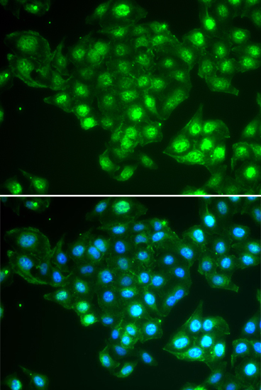 Immunofluorescence analysis of HeLa cells using ABCA3 Polyclonal Antibody