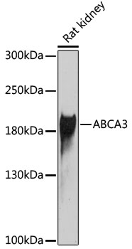 Western blot analysis of extracts of Rat kidney using ABCA3 Polyclonal Antibody at dilution of 1:1000.