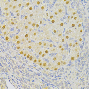 Immunohistochemistry of paraffin-embedded Rat ovary using PFKFB3 Polyclonal Antibody at dilution of  1:100 (40x lens).