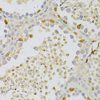 Immunohistochemistry of paraffin-embedded Mouse testis using PFKFB3 Polyclonal Antibody at dilution of  1:100 (40x lens).