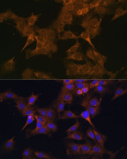 Immunofluorescence analysis of C6 cells using EIF2B2 Polyclonal Antibody at dilution of  1:100. Blue: DAPI for nuclear staining.