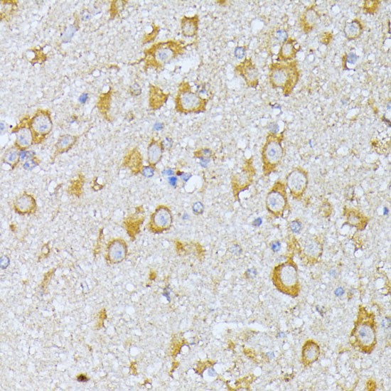 Immunohistochemistry of paraffin-embedded Mouse brain using EIF2B2 Polyclonal Antibody at dilution of  1:100 (40x lens).