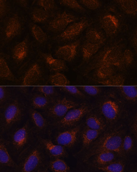 Immunofluorescence analysis of U-2 OS cells using AGR2 Polyclonal Antibody at dilution of  1:100. Blue: DAPI for nuclear staining.