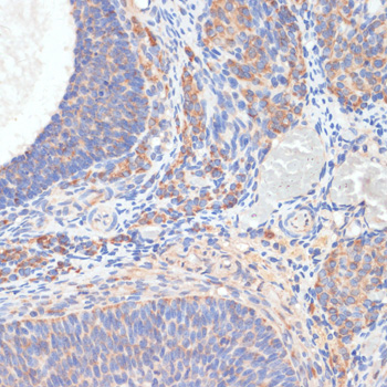 Immunohistochemistry of paraffin-embedded Rat ovary using TES Polyclonal Antibody at dilution of  1:100 (40x lens).