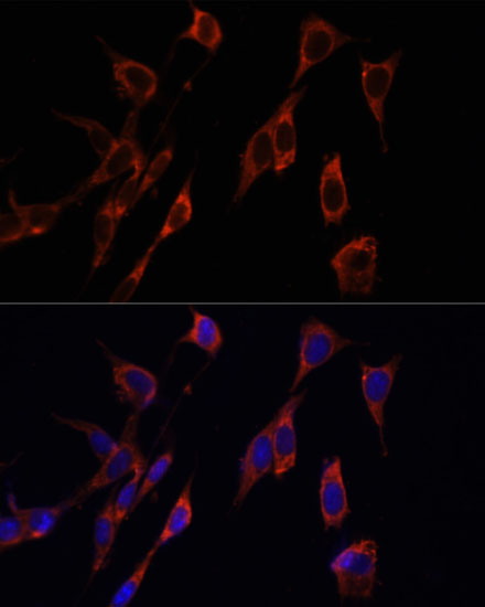 Immunofluorescence analysis of NIH-3T3 cells using PINK1 Polyclonal Antibody at dilution of  1:100 (40x lens). Blue: DAPI for nuclear staining.