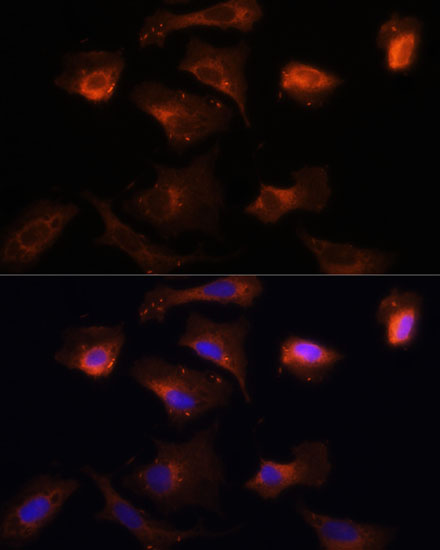 Immunofluorescence analysis of U-2 OS cells using PINK1 Polyclonal Antibody at dilution of  1:100 (40x lens). Blue: DAPI for nuclear staining.