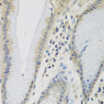 Immunohistochemistry of paraffin-embedded Human stomach using CCL26 Polyclonal Antibody at dilution of  1:200 (40x lens).