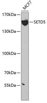 Western blot analysis of extracts of MCF-7 cells using SETD5 Polyclonal Antibody at dilution of 1:300.